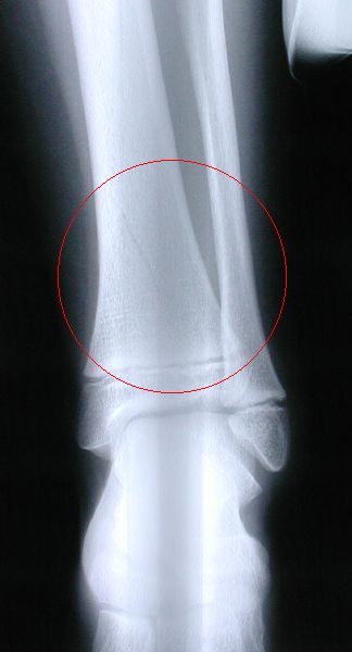Leg x-ray 2 - click for larger view
