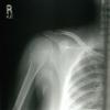 X-ray 1 - click for larger