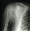 X-ray 2 - click for larger